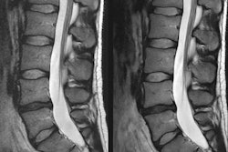 2021 12 07 16 11 7602 2021 12 06 Spine Ai 20211207163009