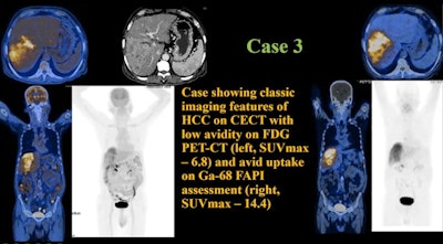 Image courtesy of Dr. Vineel Inampudi.