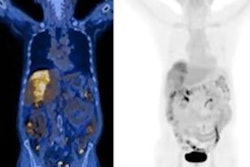 2021 12 08 22 47 5510 2021 12 10 Ga 68 Fapi Hcc 20211208224747