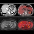 2021 12 09 22 12 7218 2021 12 10 Peritoneum Cancer 400
