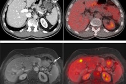 2021 12 09 22 12 7218 2021 12 10 Peritoneum Cancer 400