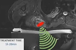 2021 12 10 00 20 9137 2021 12 10 Rsna Alfieri Mri Ultrasound 20211210000144