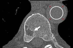 2021 12 14 19 13 1412 2021 12 14 Radiology Rajendran Figure5 400