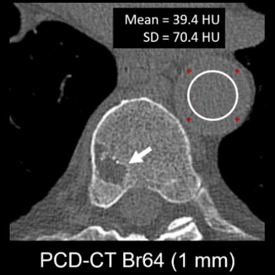 Full Body CT Scans Las Vegas - PDC