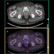 2021 12 21 23 27 1674 2021 12 23 Pet Prostate Cancer 400