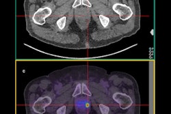 2021 12 21 23 27 1674 2021 12 23 Pet Prostate Cancer 400