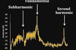2021 12 20 23 03 0902 2022 01 03 Rsna Subharmonic Ultrasound 20211220231529