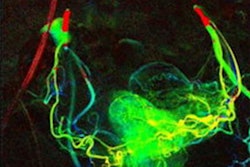 2021 12 22 22 56 5886 2022 01 04 Digital Variance Angiography 20211222225033