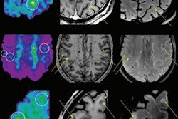 2022 01 04 22 52 4693 2022 01 05 Mri Brain Changes Figure3 20220104224623