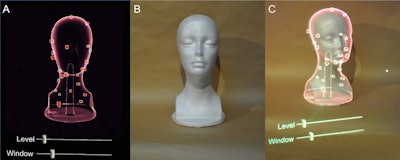 Creating a 3D virtual rendering and superimposing it on the real world. After creating a 3D virtual rendering from SPECT/CT images (A), the 3D virtual rendering can be superimposed on a real-world mannequin (B) using voice commands on the AR headset. Bars were set to adjust the level and width of the window with hand gestures to optimize the visibility of simulated lymph nodes while wearing the AR headset (A, C). Image courtesy of Oral Oncology.