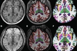 2022 01 06 18 30 0323 2022 01 06 Volumetry Mri 400