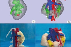 2022 01 11 22 41 4467 2022 01 11 3 D Printing 400