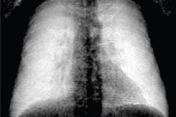 2022 01 12 21 42 0741 2021 01 13 Dark Field Chest X Ray Red 20220112214038