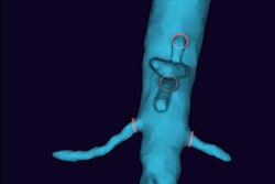 2022 01 18 17 20 5713 2022 01 18 Philips 20220118171331