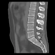 2022 01 18 21 29 9205 2022 01 18 Bone Mri