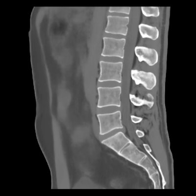 BoneMRI generates 3D MRI images aimed at enhancing visualization of bone structures. Image courtesy of MRIguidance.