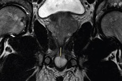 2022 01 19 23 36 1495 2022 01 20 Mul Image 20220119235749