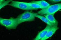 2022 01 20 22 04 8815 Melanoma 400