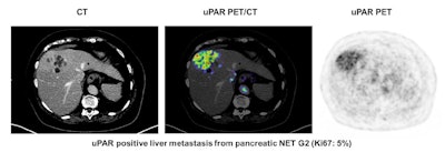 Image courtesy of the Journal of Nuclear Medicine.