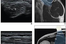 2022 01 25 00 22 7199 2022 01 20 Jeung Elastography Rotator Cuff 20220125002818