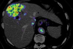 2022 01 25 00 45 3630 2022 01 25 U Par Pet Tracer Uptake 20220125005614