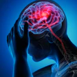 2021 04 22 23 05 5088 Brain Stroke 400