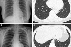 2022 01 31 21 20 5461 2022 02 01 Rsna Figure 2a 400