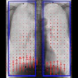 2022 02 01 19 13 8587 2022 02 03 Dxr Copd 400
