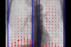 2022 02 01 19 13 8587 2022 02 03 Dxr Copd 400