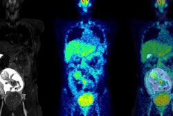 2022 02 07 20 15 1982 2022 02 08 Fdg Pet Mri Pregnancy Lg 20220207202946