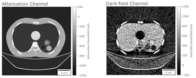 Dark-field CT reconstruction of a clinical chest phantom. Besides conventional attenuation contrast, dark-field contrast is also retrieved, providing information on the porosity of tissue. Here, the chest phantom is filled with a foam insert that simulates lung tissue, and tubes containing different materials (left-to-right: POM, air, powdered sugar, water). While purpose structures are too small and have low conventional attenuation CT, they are easily visible in the dark-field image. Image and caption courtesy of Manuel Viermetz.