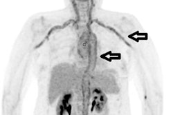 2022 02 08 19 18 3968 2022 02 09 Fuo Fdg Pet 20220208192416