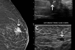 2022 02 08 21 25 6841 2022 02 08 Radiology Adenopathy Mammogram 20220208211611