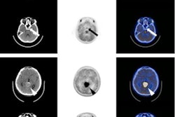 2022 02 09 17 50 8136 2022 02 10 Met Pet Germinomas 20220209175225