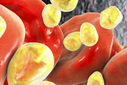 2022 02 11 16 48 3875 Blood Cholesterol 400