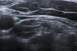 2022 02 14 19 33 3540 2022 02 11 Llados Ultrasound Vagus Nerve 2 20220214193605