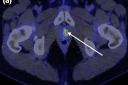 2022 02 17 17 54 8850 2022 02 18 Mri Pet Prostate Cancer 400