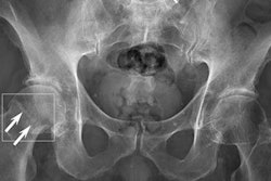 2022 02 23 22 28 3834 2022 02 24 Ai Fractures 20220223225609