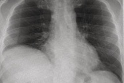 2022 02 26 00 35 3362 2022 02 25 Dcr Diaphragm Dysfunction 20220226005220