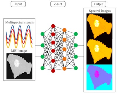 Researchers developed the Z-Net deep-learning algorithm for real-time reconstruction of images that combine spectral and MRI data. This could allow better breast cancer screening and diagnosis. Graphic courtesy of Keith Paulsen, PhD.
