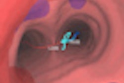 2009 12 11 14 59 36 837 Bronchus Bai Thumb