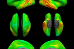 2022 03 01 00 02 7073 2022 03 01 Tau Pet 400