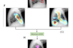 2022 03 01 05 19 7637 2022 03 01 Ai Tb 400