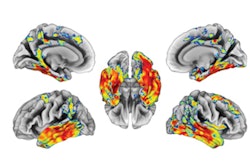 2022 03 02 19 53 8558 2022 03 04 Tau Biomarkers 400