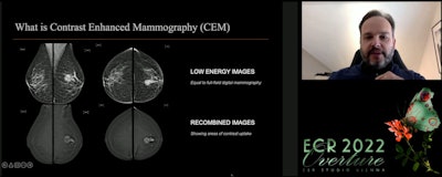 Dr. Marc Lobbes, PhD, vouched for contrast-enhanced mammography's advantages over breast MRI at the ECR Overture on March 2. Lobbes focused on this method's performance in comparison to MRI, as well as efficiency in patient imaging times and machine costs for facilities.
