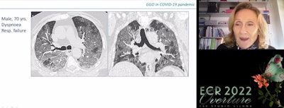 Dr. Anna Rita Larici of the Catholic University of Sacro Cuore in Rome, Italy, presenting on March 2 at ECR 2022 Overture.