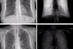 2022 03 10 00 14 2822 2022 03 11 Dark Field X Ray Ecr 20220310000734