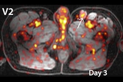 2022 03 14 18 44 0839 2022 03 15 Immuno Pet Hiv 400