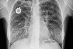 2022 03 16 02 06 2027 2022 03 16 Dynamic Chest X Ray 20220316023753