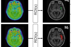 2022 03 18 23 47 6464 2022 03 21 Tau Pet Overlap Index 400
